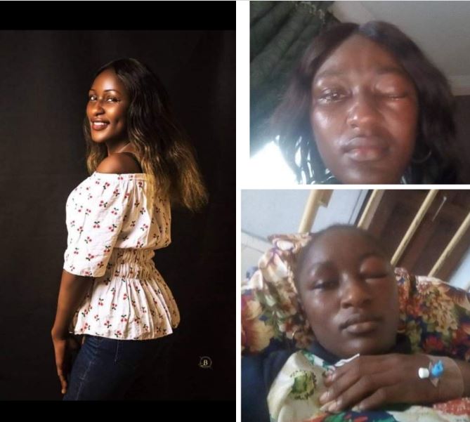 Nigerian woman cries out after husband allegedly battered her