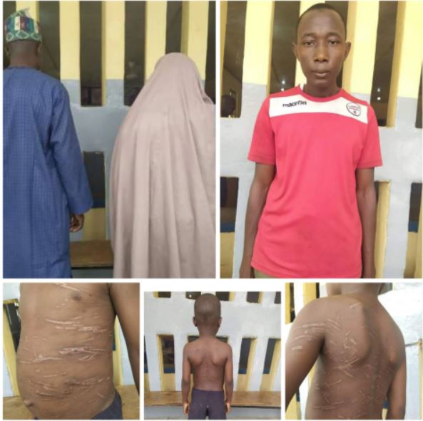 Kano police arrest teacher for gruesome torture of 8-year-old boy