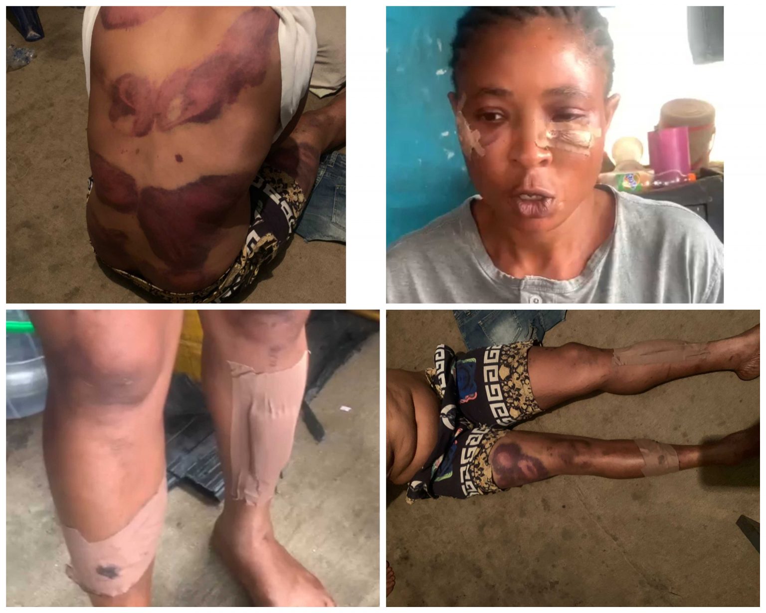 Blessing Mba, woman brutalized by Police DPO in Osun missing