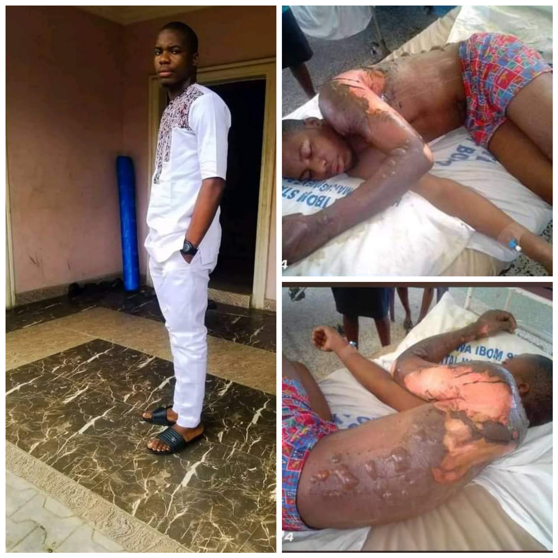 Roadside petrol dealer allegedly sets varsity student ablaze in Akwa Ibom