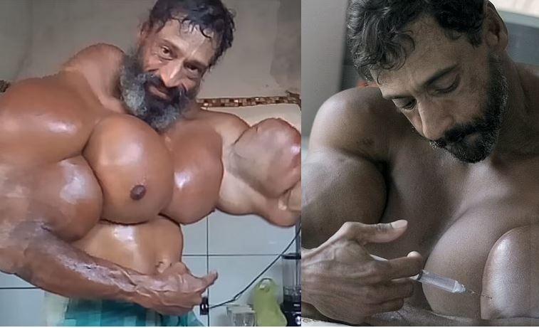 'Brazilian Hulk' and TikTok star, Valdir Segato who injected himself with life-threatening oil to create 23-inch biceps, dies on his 55th birthday